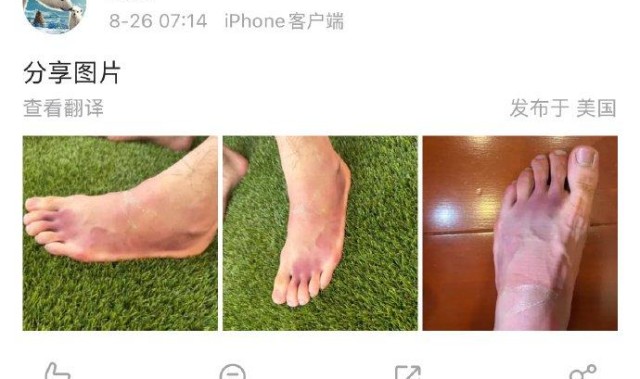 必发官网-美网商竣程因左脚淤血退赛，父亲商毅通报伤情